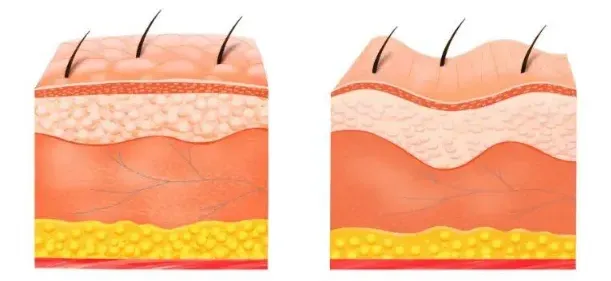 info-611-281 info-611-281